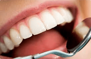 Jak zachować efekt wybielania zębów na dłużej?